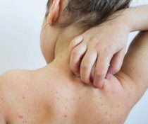 Ποια λοιμώδη νοσήματα προλαμβάνουν τα εμβόλια Ιλαρά