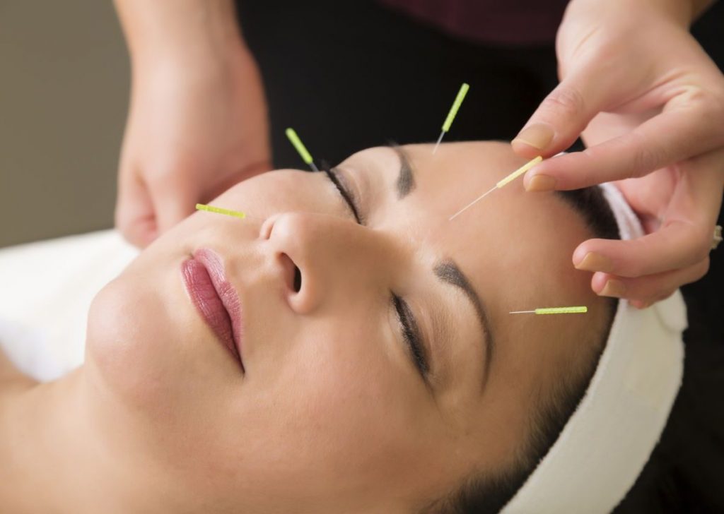 Βελονισμός στο πρόσωπο 