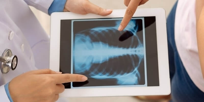 Χτύπημα στα πλευρά 