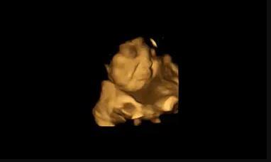 4D εικόνα παρουσιάζει τον δυσαρεστημένο μορφασμό του εμβρύου όταν η μητέρα τρώει λάχανο