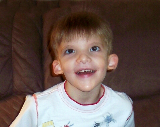 Σύνδρομο Wilson 