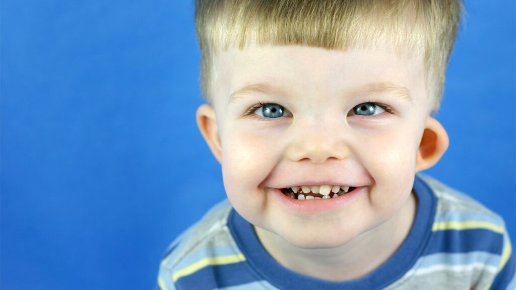 Σύνδρομο Williams