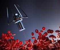 Χρόνια λεμφοκυτταρική λευχαιμία θεραπεία