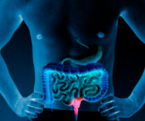 Crohn