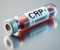 CRP τι είναι; αυξημένη αιματοκρίτης καρκίνος