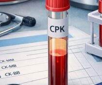 CPK εξέταση αίματος – τι δείχνει