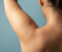 γυναίκα με υγρασία απο μπανιο και σύγκαμα